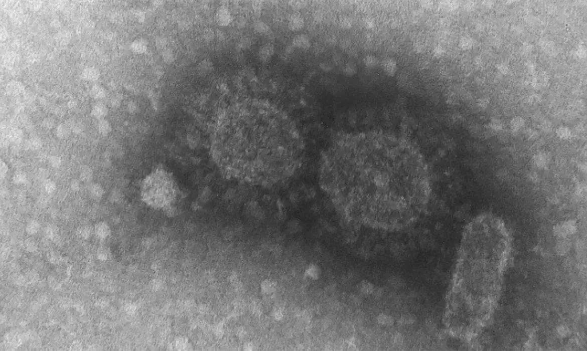 Maioria das doenças infecciosas tem origem em animais selvagens
