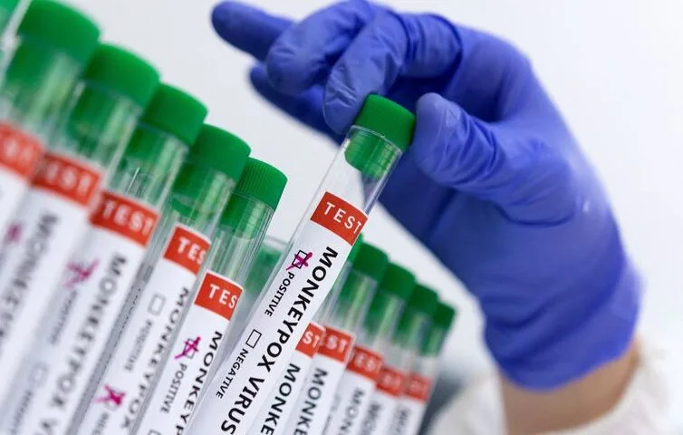 Monkeypox no Ceará: 31 cidades concentram casos confirmados da doença