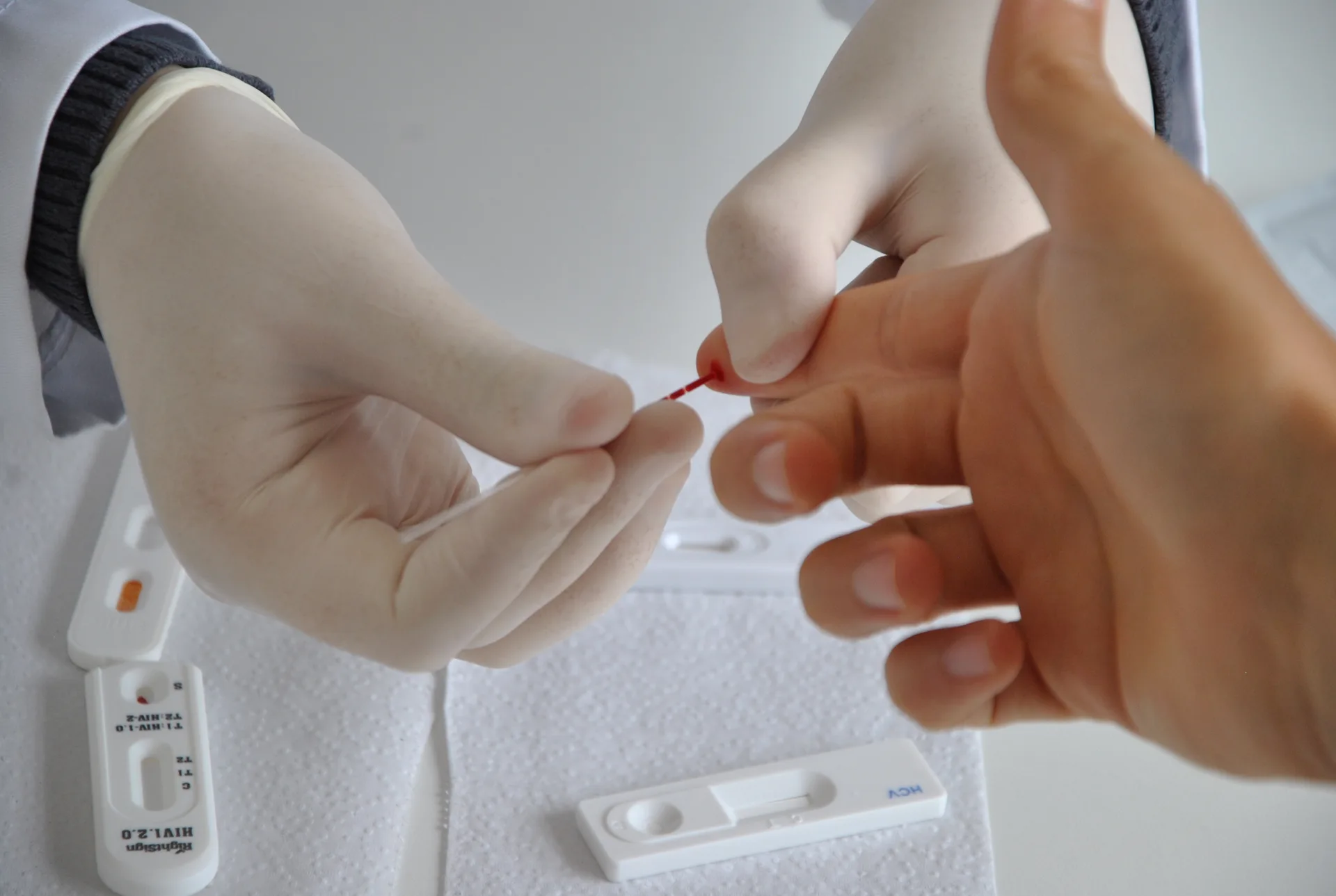 Projeto "A Hora é Agora" amplia acesso à testagem de HIV em Fortaleza