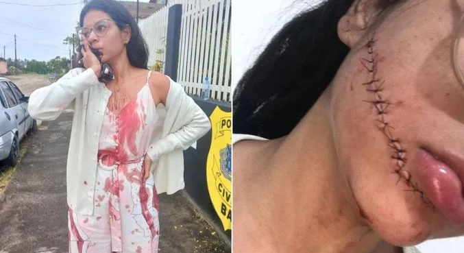 ‘Desconfiei dessa mulher desde o começo’, diz jovem que teve rosto cortado em ônibus sobre suspeita