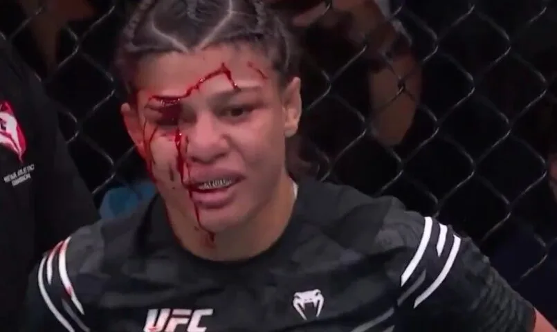 Brasileira Mayra Sheetara sofre corte grotesco e perde luta no UFC 303