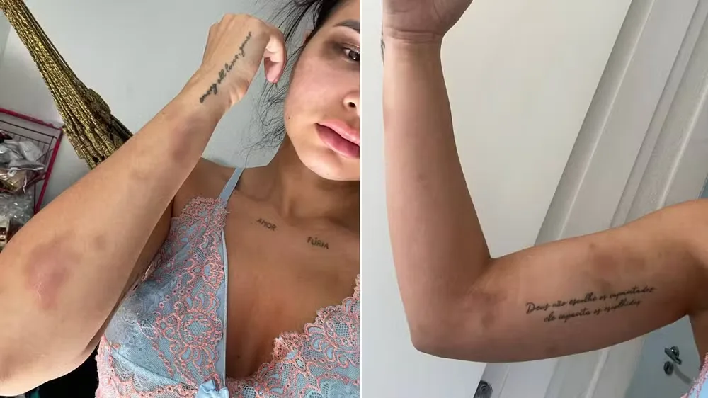 Modelo cearense denuncia agressão do ex-companheiro e tem lesões na cabeça, pescoço, olho e tórax