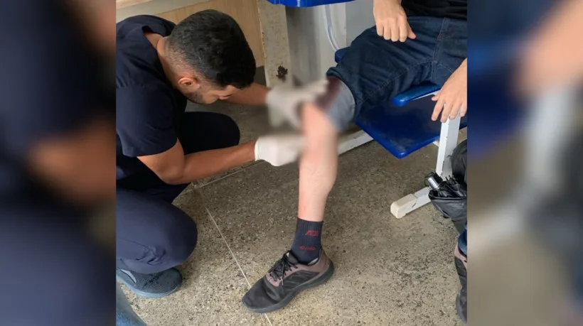 Estudante da UFC é esfaqueado em tentativa de assalto próximo ao campus do Porangabuçu