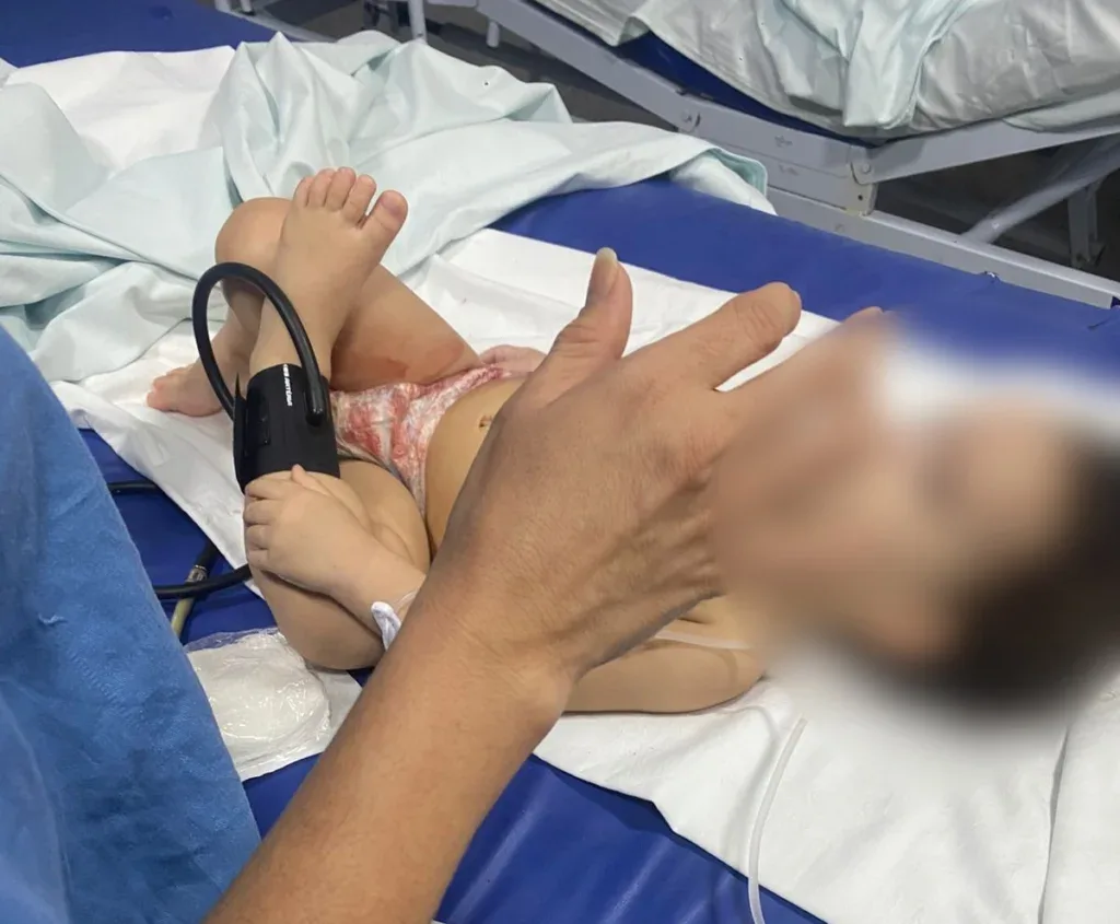 Mãe e padrasto são presos após bebê ser baleada dentro de casa em Fortaleza
