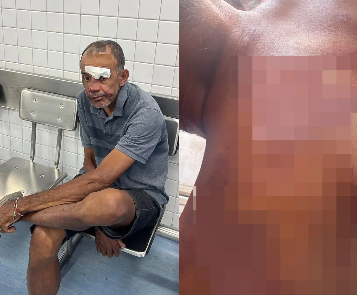 Em entrevista à TV Cidade, baiano relata agressão em barraca de praia em Fortaleza