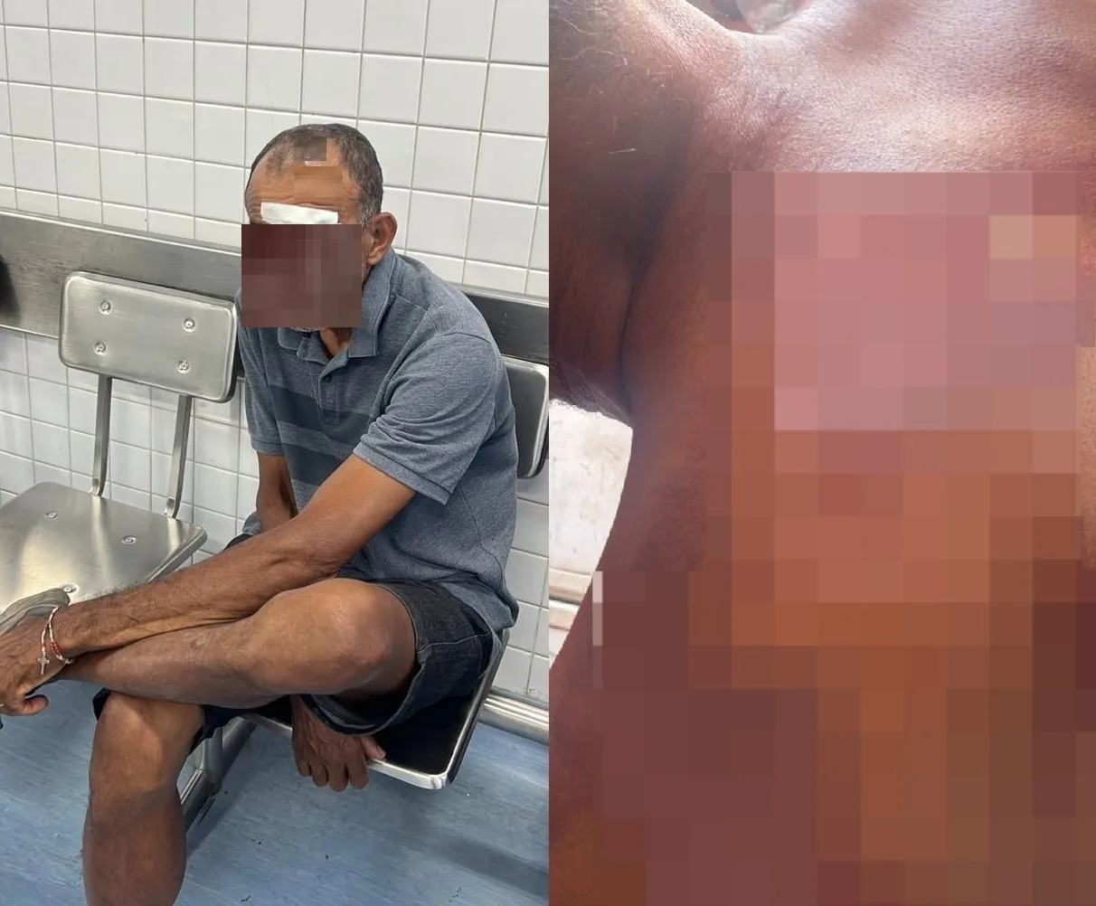 Em entrevista à TV Cidade, baiano relata agressão em barraca de praia em Fortaleza