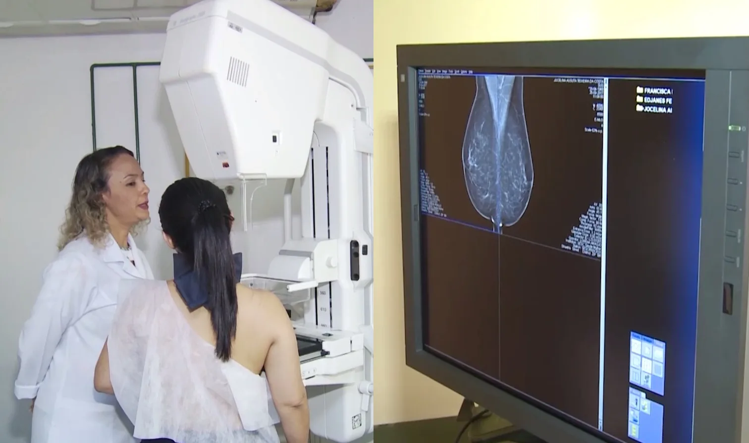 A campanha Outubro Rosa busca ampliar a circulação de informações sobre prevenção e diagnóstico precoce da doença. Foto: Reprodução / TV Cidade Fortaleza Outubro Rosa: Ceará tem maior proporção de diagnósticos tardios de câncer de mama no Nordeste