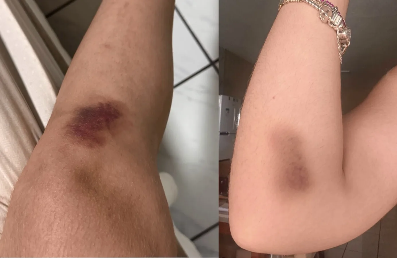 Polícia investiga denúncia de agressão contra estagiária no local de trabalho em Jaguaribe, no Ceará